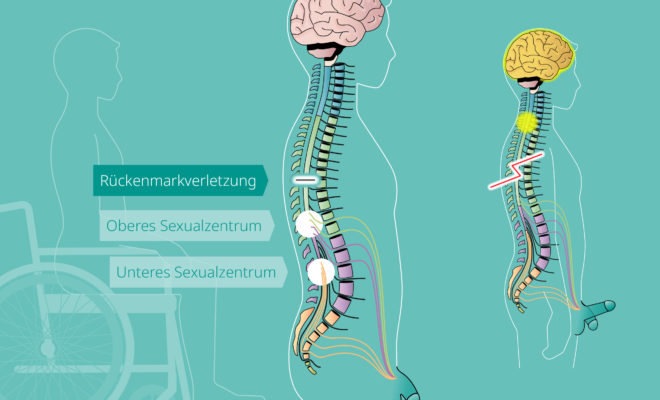 Querschnittslähmung Bohm und Nonnen Bohm Nonnen Urhahn